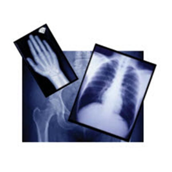 Agfa Corporation Film X-Ray Radiomat Gplus 8X10" 100/Box - EZP2B