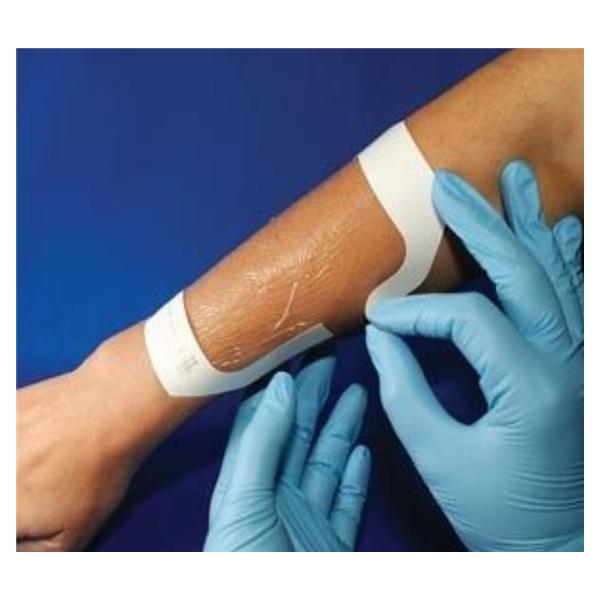 AMD Ritmed Dressing Window Allevyn Ag Polyurethane Film 6X7Cm Non-Adhesive 400/Ca - A60022-W