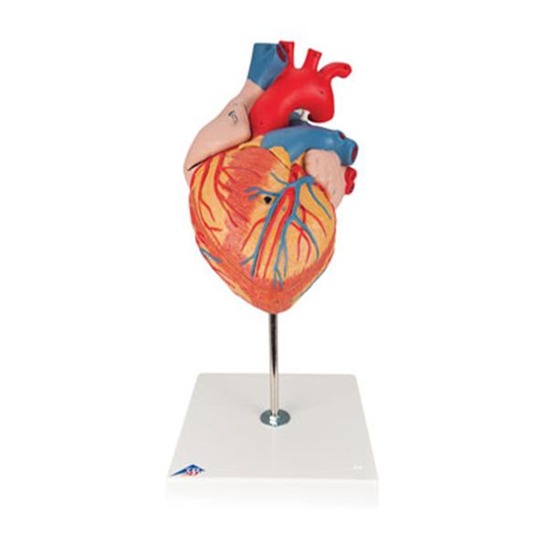 American 3B Heart Model Anatomical 2 Times Life Size/ 4-Part Ea - Z13061