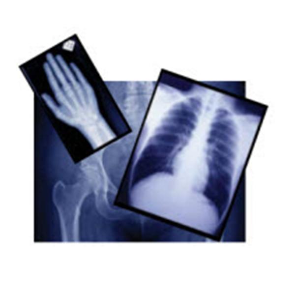 Agfa Corporation Film X-Ray Radiomat Gplus 10X12" 100/Box - EZP5H