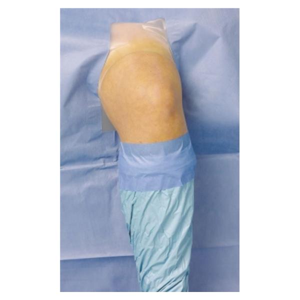 3M Healthcare Drape Surgical/Orthopedic Steri-Drape Fenestrated 228X3Cm Blue Sterile 2X10/Case - 9053