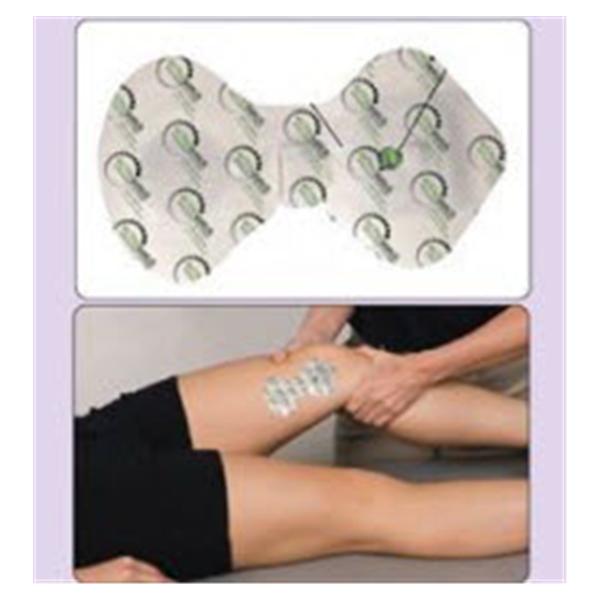 Activatek System Iontophoresis Activapatch 6/Bx - 81516608