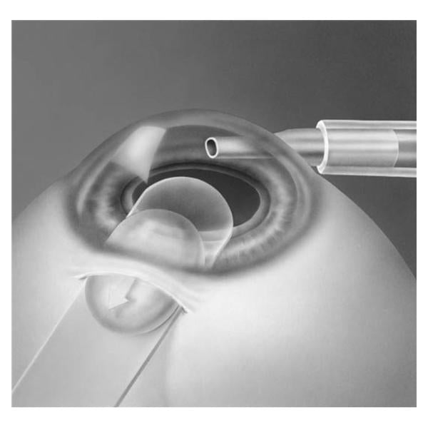 Beaver-Visitec Int Glide Surgical Visitec Fichman 50/Bx - 581049