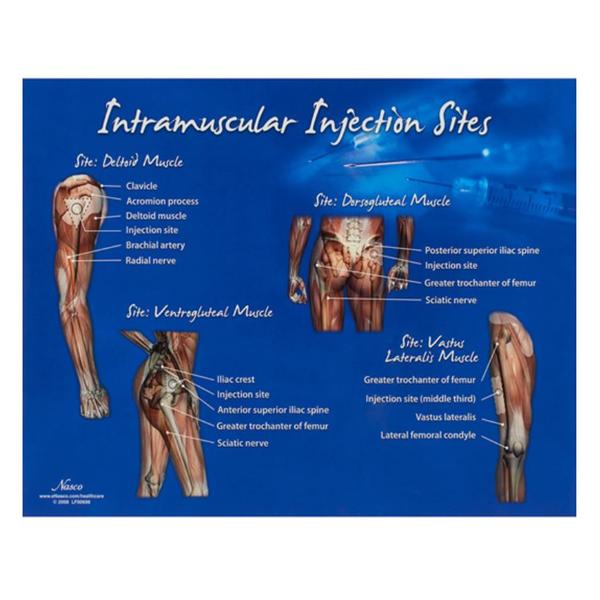 Nasco Company Chart Training Intramuscular Injection Sites 10-1/2X14" Each - LF00696U