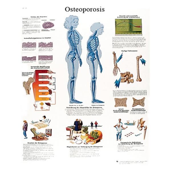 Fabrication Enterprises Chart Anatomical Spinal Column 20X25" Ea - 12-4615L