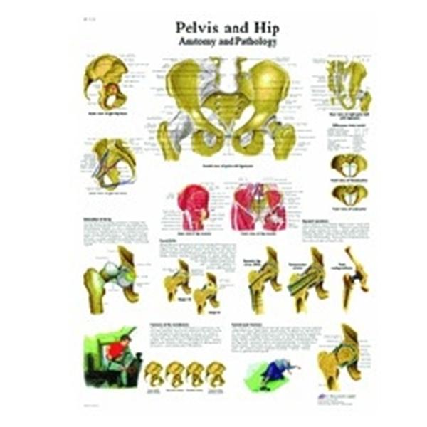 3B Scientific GMBH Chart Anatomical Pelvis And Hip 20X26" Ea - 12-4617L