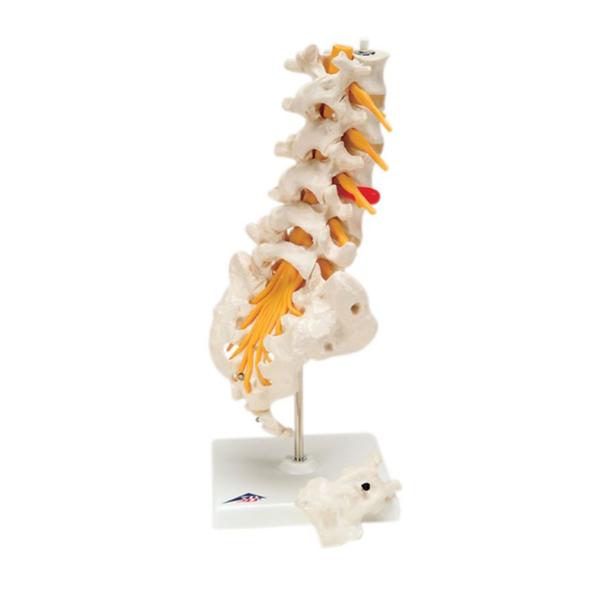 Fabrication Enterprises Model Educational Lumbar Spinal Column Ea - 965672