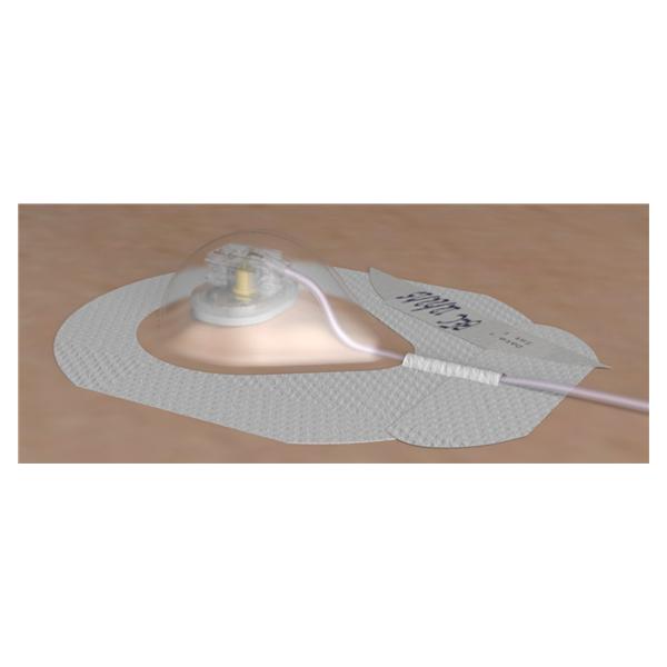 Bard Access Systems Kit Port Access Allpoints 20Gx1" With Guardiv Dressing Sterile 10/Case - AN162010G