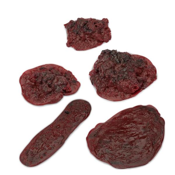Nasco Company Clot/Hemorrhage Model Set Life/Form Each - LF00714U