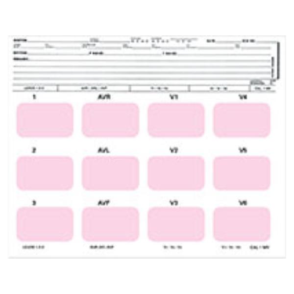 Beck-Lee/Clinical Health Mount Electrocardio Beck-Lee 100/Box - 2301